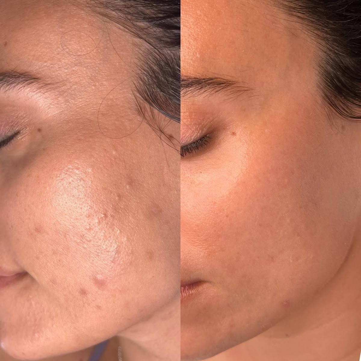 before/after 6 weeks