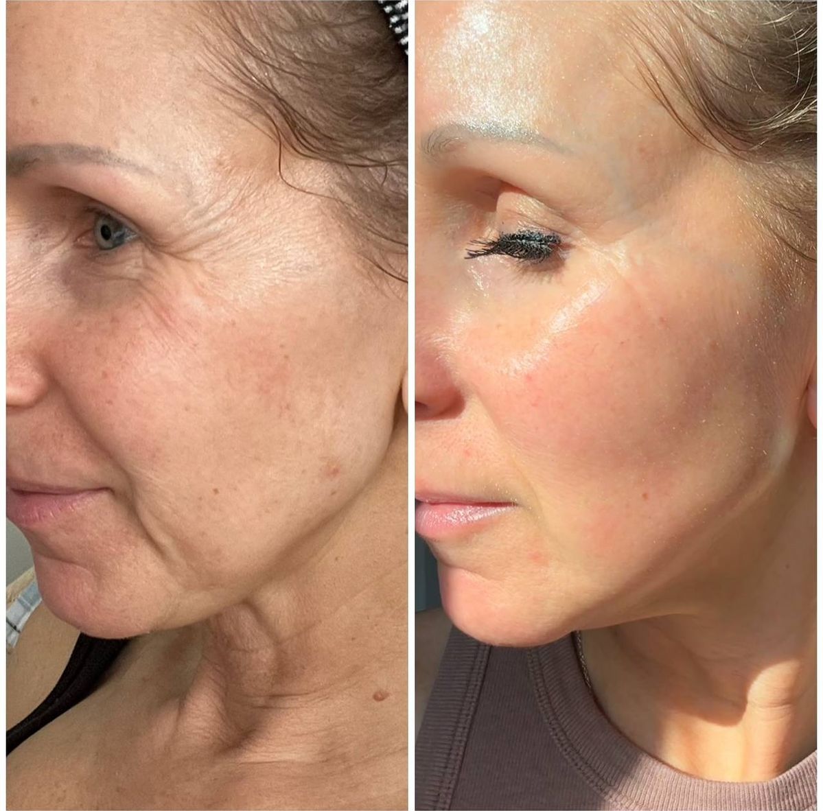 before/after 6 weeks